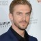 Dan Stevens Photo